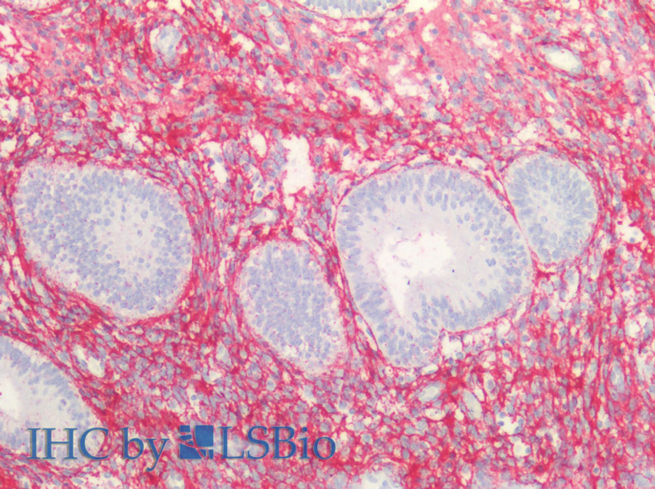 Immunohistochemistry of paraffin-embedded Human endometrium and prostate using COL3A1 Polyclonal Antibody at dilution of 1:100(Elabscience® Product Detected by Lifespan).