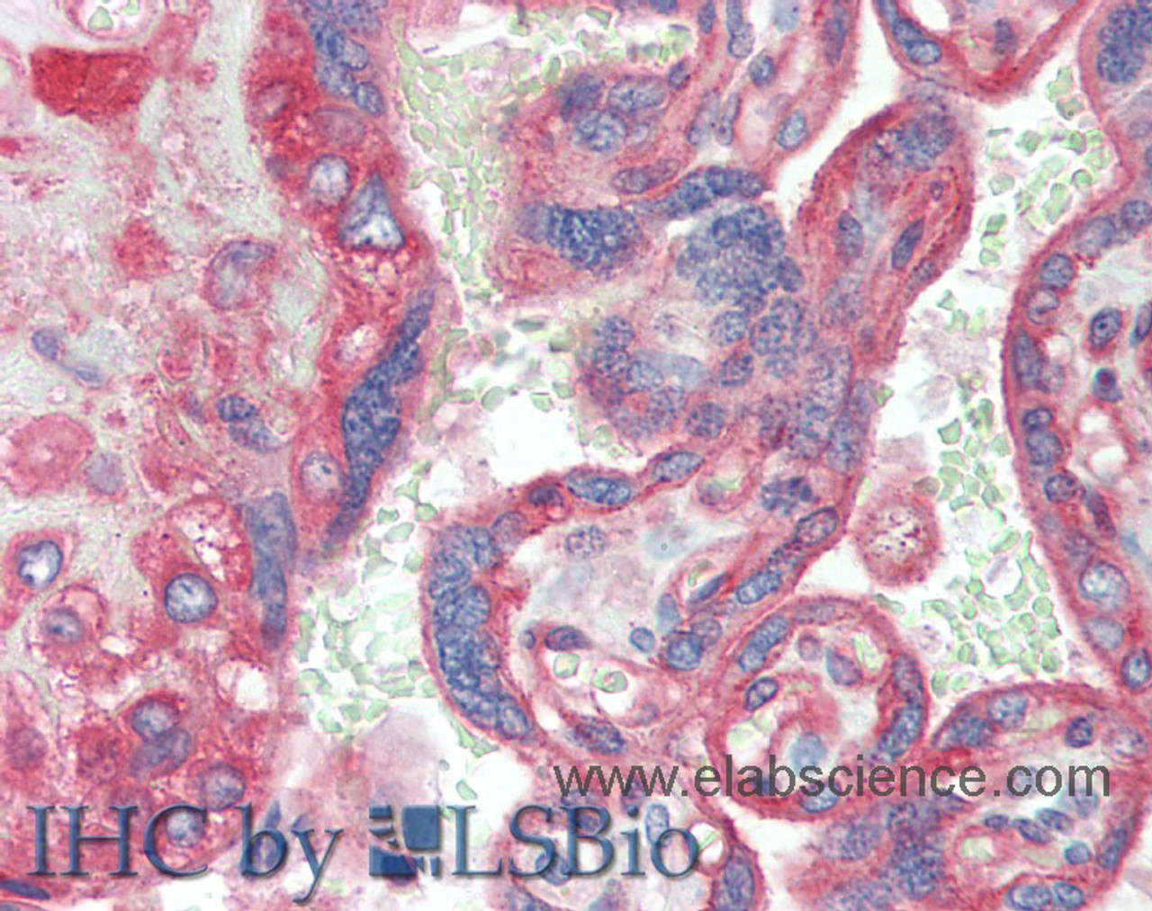Immunohistochemistry of paraffin-embedded Placenta tissue using CD151 Polyclonal Antibody at dilution of 1:120(Elabscience® Product Detected by Lifespan).
