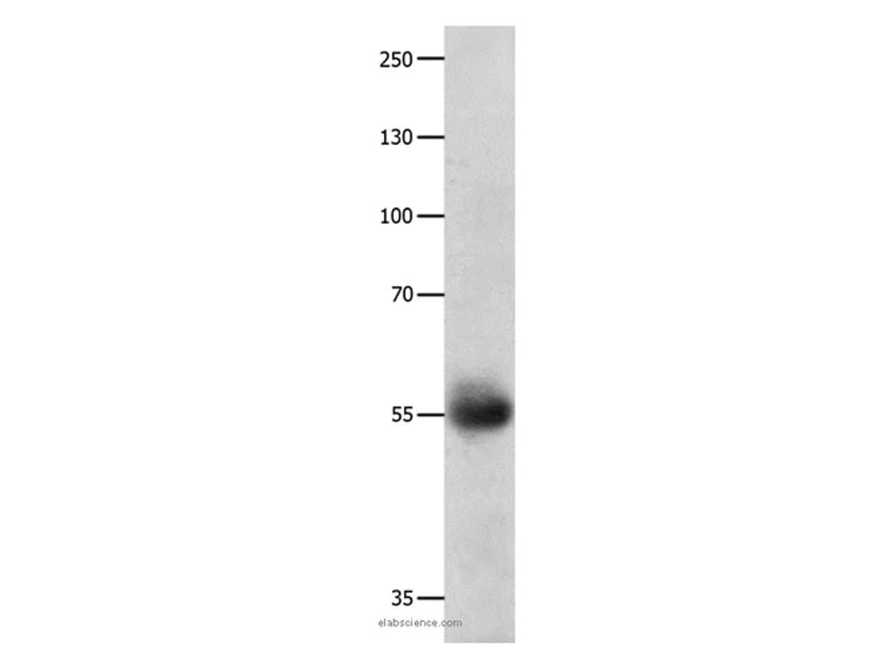 Western Blot analysis of Human ovarian cancer tissue using DRD5 Polyclonal Antibody at dilution of 1:800