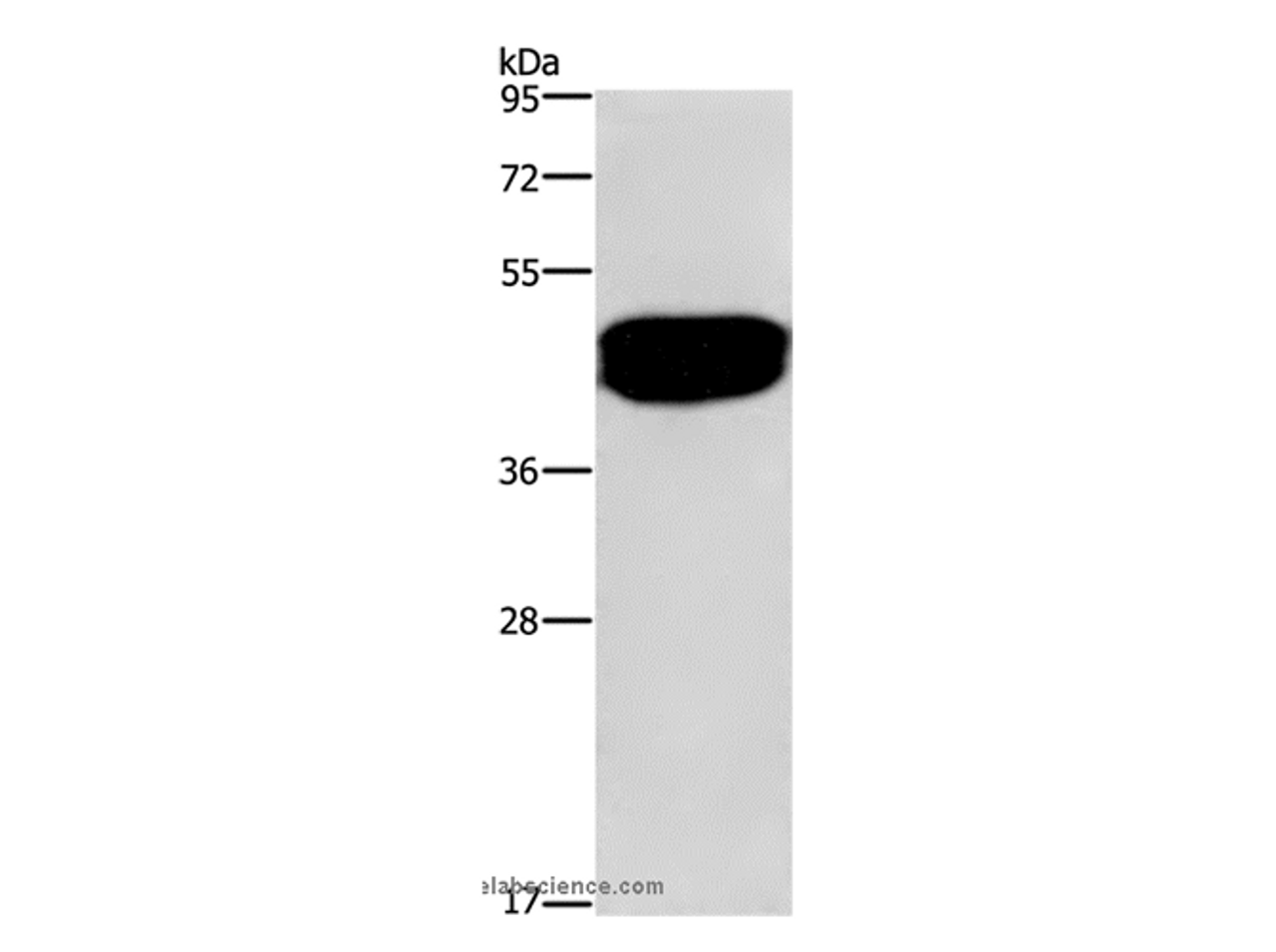 Western Blot analysis of Human prostate tissue using SDCCAG3 Polyclonal Antibody at dilution of 1:500