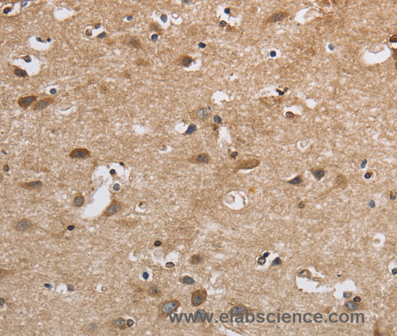 Immunohistochemistry of paraffin-embedded Human brain  using SDCCAG3 Polyclonal Antibody at dilution of 1:30