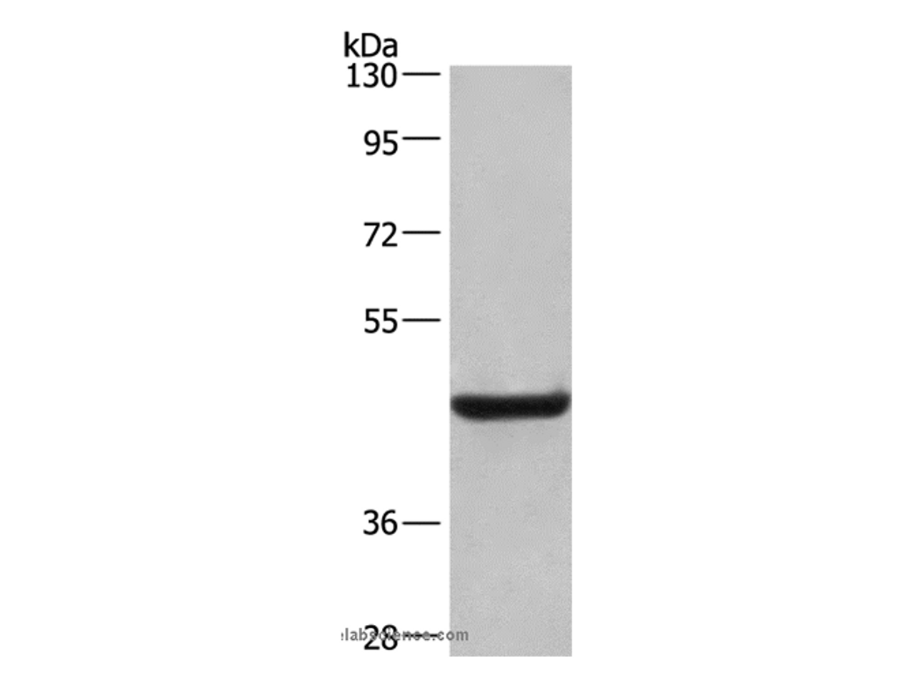 Western Blot analysis of Human placenta tissue using CD107b Polyclonal Antibody at dilution of 1:500