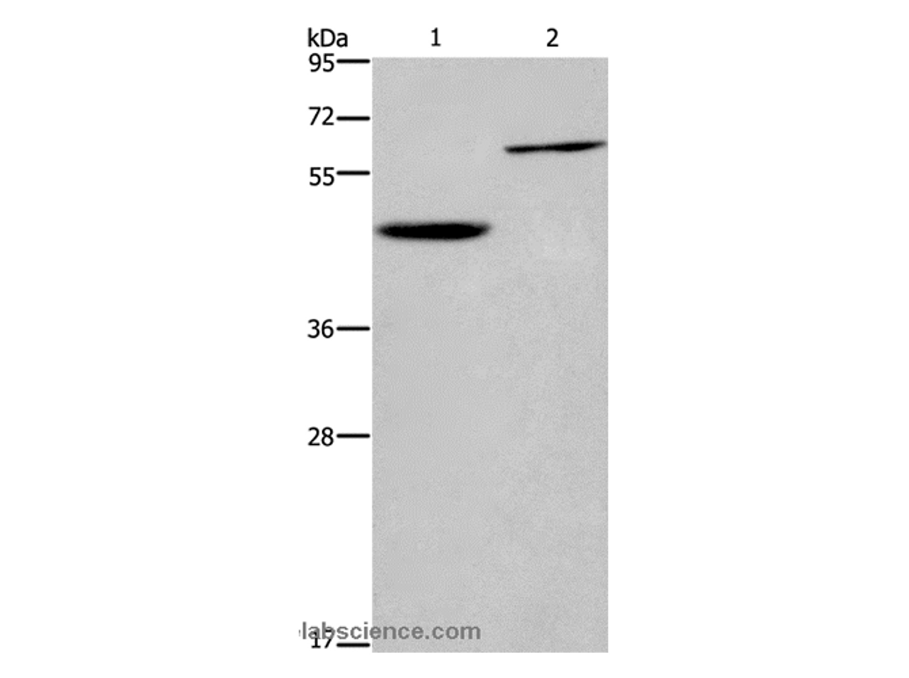 Western Blot analysis of Human hepatocellular carcinoma tissue and Jurkat cell   using DOK1 Polyclonal Antibody at dilution of 1:450