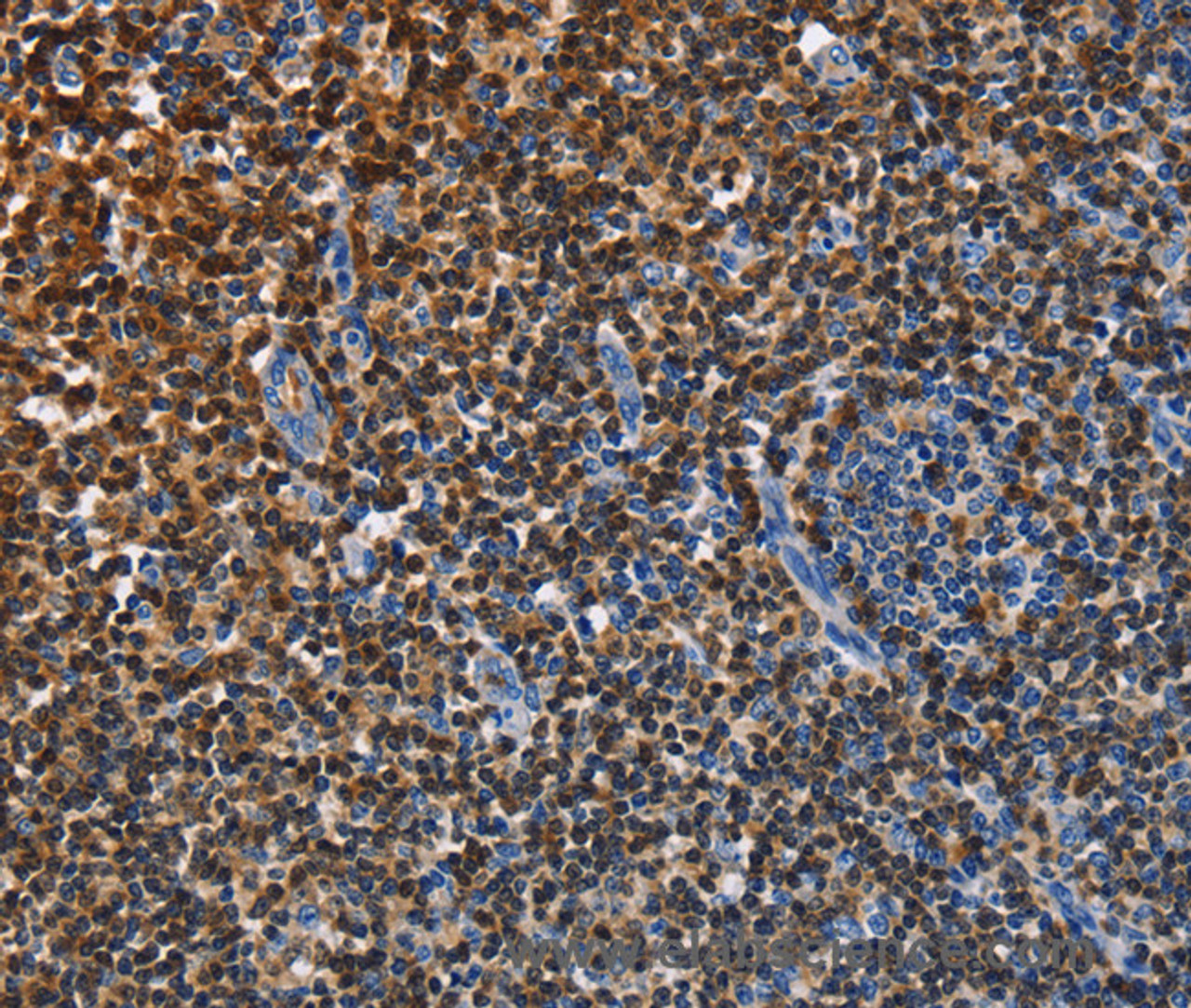 Immunohistochemistry of paraffin-embedded Human tonsil tissue using ENPP5 Polyclonal Antibody at dilution 1:40