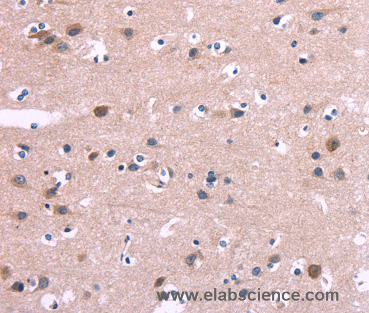 Immunohistochemistry of paraffin-embedded Human brain  tissue using DUSP13 Polyclonal Antibody at dilution 1:60
