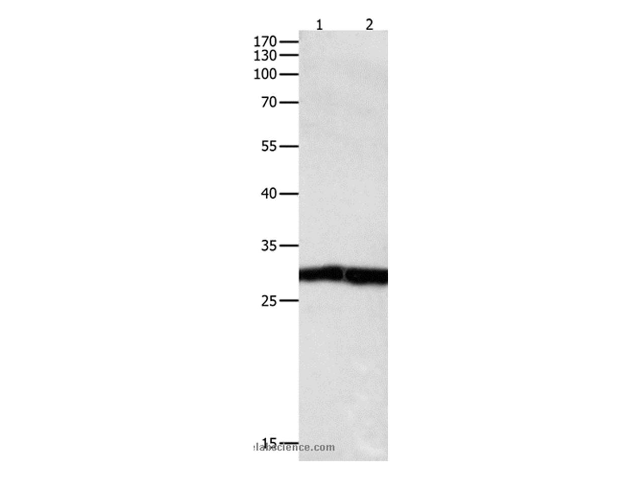 Western Blot analysis of Jurkat cell and Human fetal kidney tissue using MKP-3 Polyclonal Antibody at dilution of 1:450