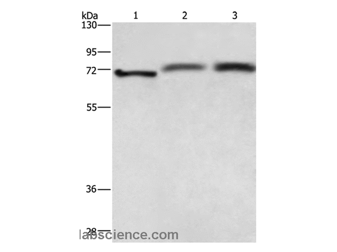 Western Blot analysis of Hela cell, Human fetal brain and hepatocellular carcinoma tissue  using RDX Polyclonal Antibody at dilution of 1:700