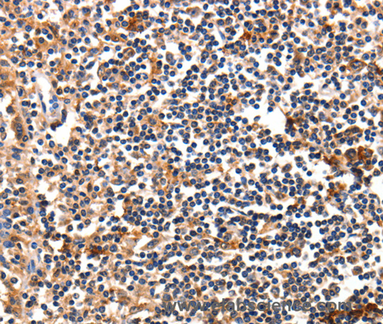 Immunohistochemistry of paraffin-embedded Human tonsil using FADD Polyclonal Antibody at dilution of 1:35