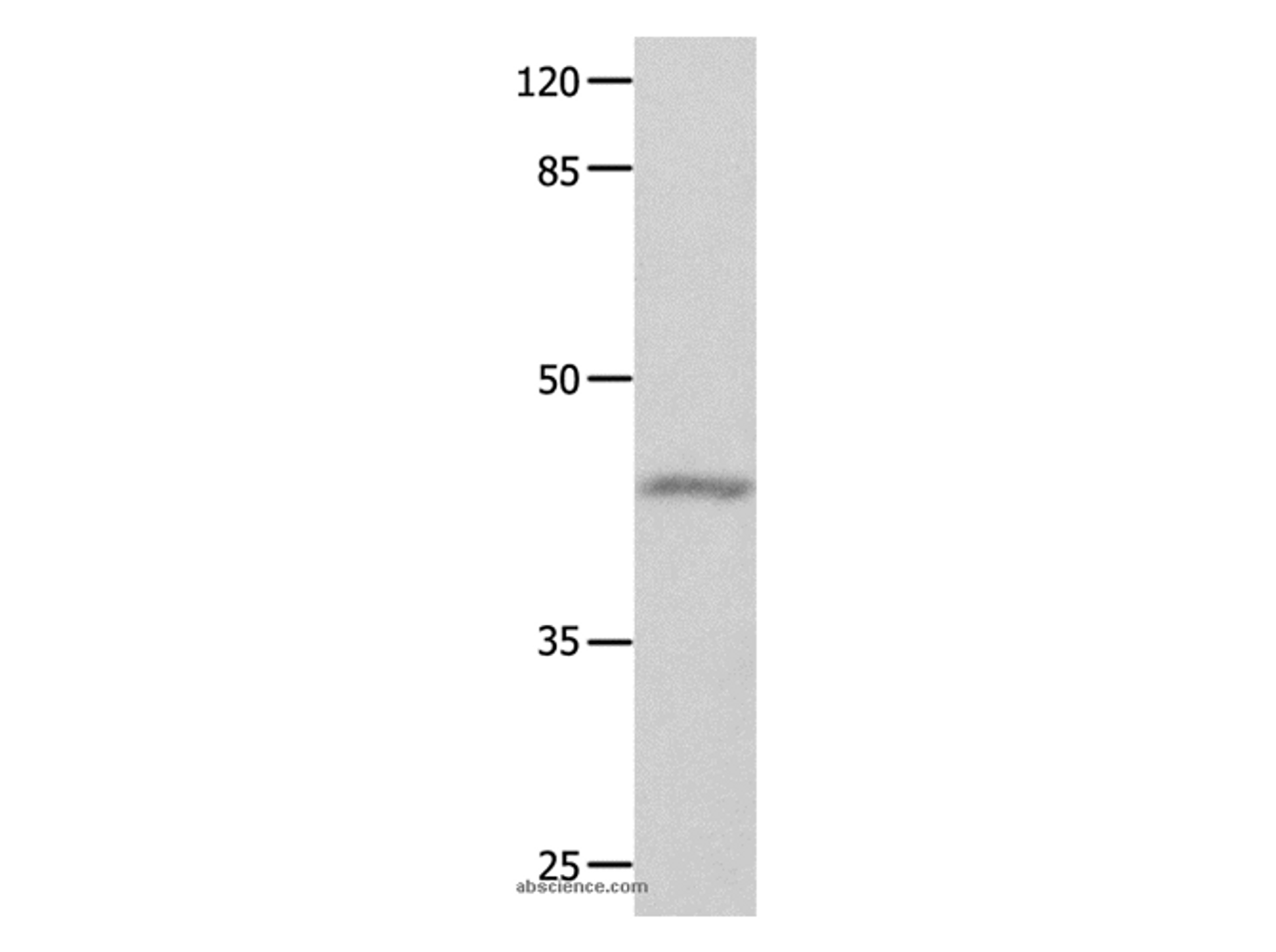 Western Blot analysis of Mouse eyes tissue using GNA11 Polyclonal Antibody at dilution of 1:550