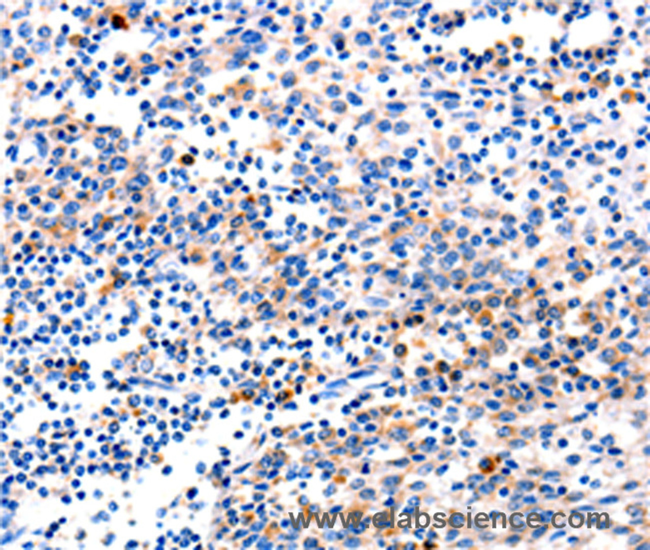 Immunohistochemistry of paraffin-embedded Human tonsil tissue using GADD45 gamma Polyclonal Antibody at dilution 1:120