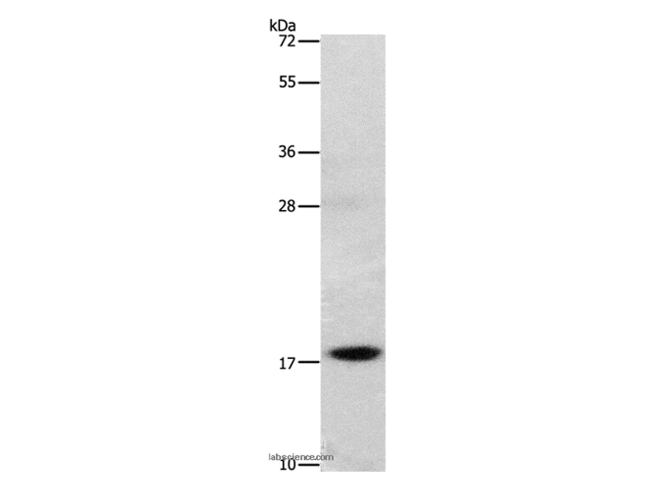 Western Blot analysis of Mouse stomach tissue using GRP Polyclonal Antibody at dilution of 1:1000