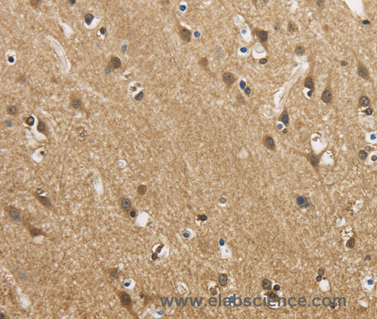 Immunohistochemistry of paraffin-embedded Human brain  using GAS7 Polyclonal Antibody at dilution of 1:50