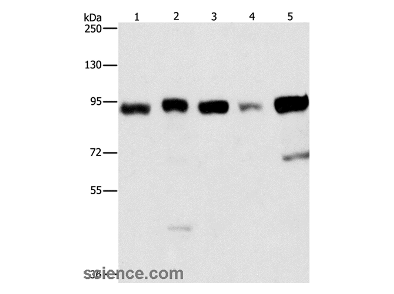 Western Blot analysis of Raji and 231 cell, hepG2、hela and 293T cell using IMMT Polyclonal Antibody at dilution of 1:270