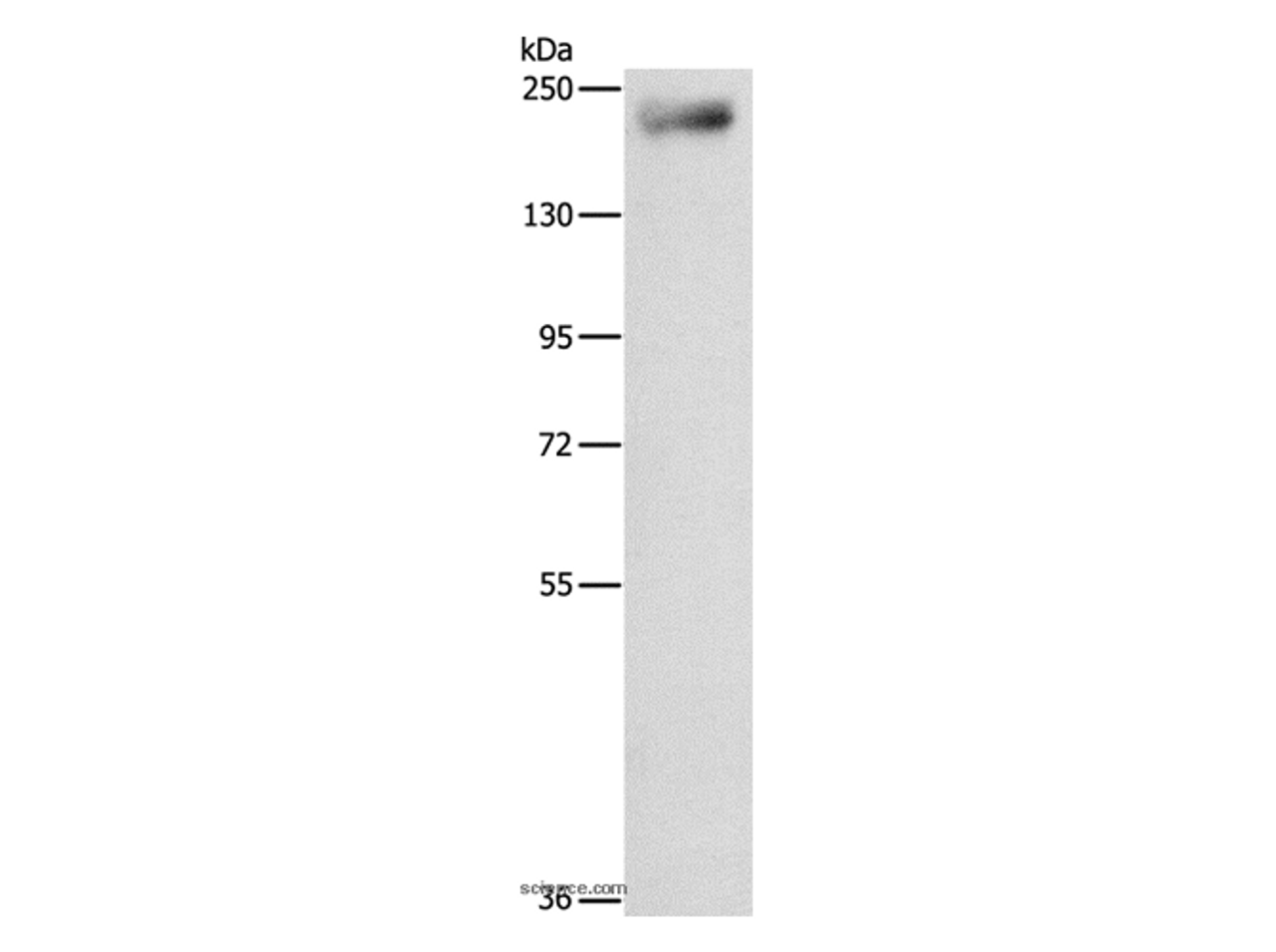 Western Blot analysis of Mouse lung tissue using IQGAP3 Polyclonal Antibody at dilution of 1:850