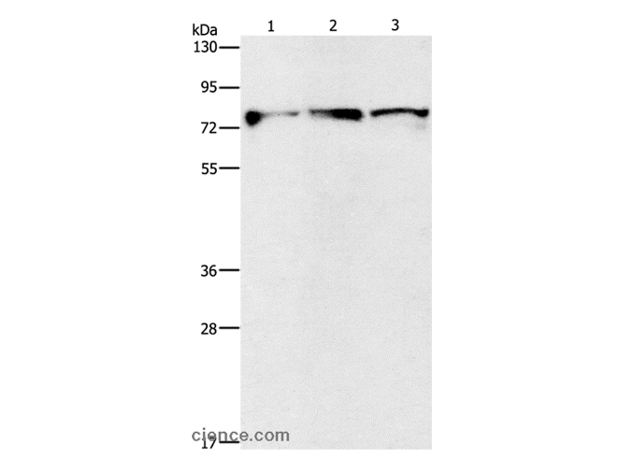 Western Blot analysis of Mouse brain and Human fetal brain tissue, Human brain malignant glioma tissue using KIF3A Polyclonal Antibody at dilution of 1:500