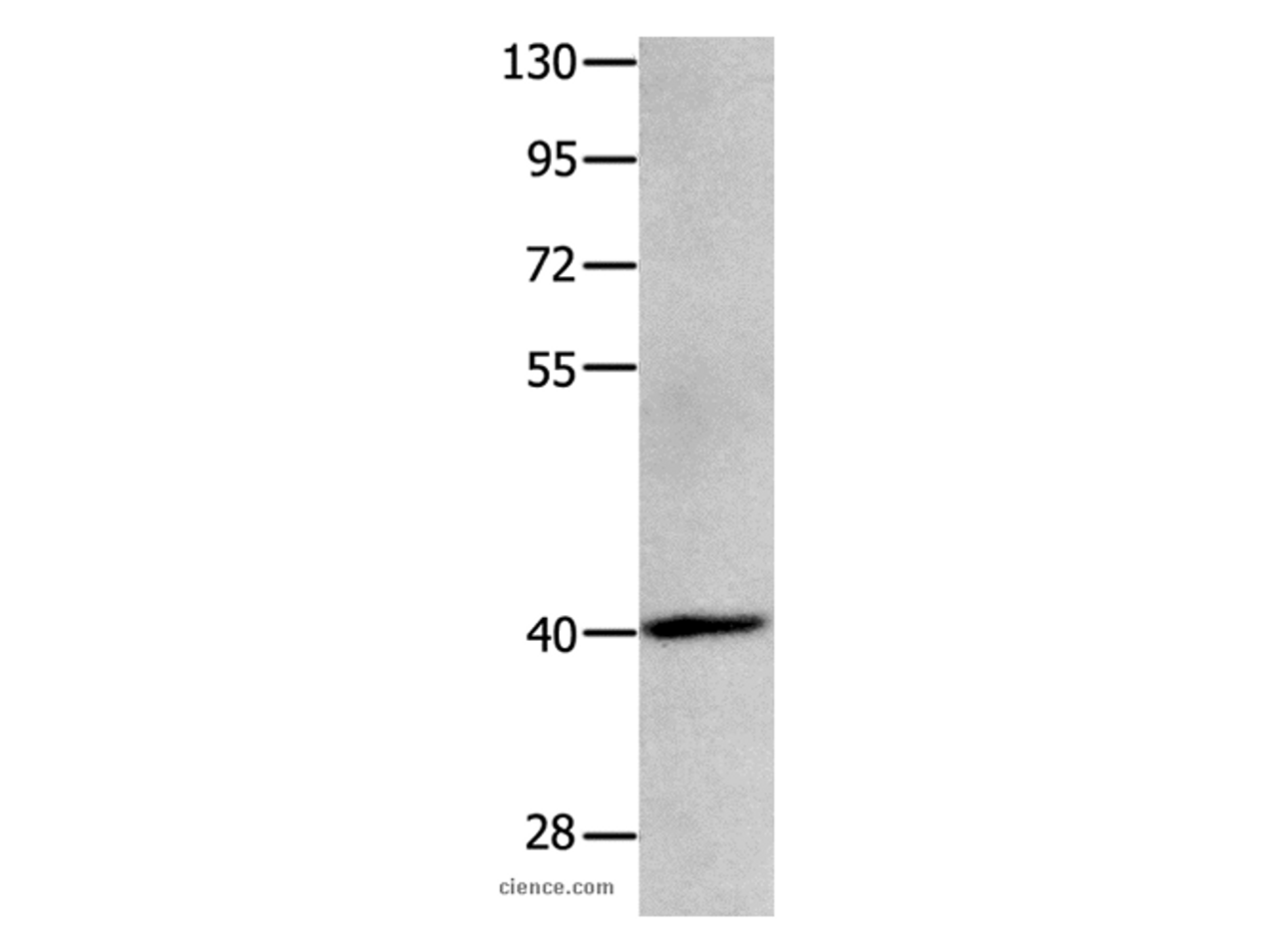 Western Blot analysis of Human brain glioma tissue using MAGEB4 Polyclonal Antibody at dilution of 1:550