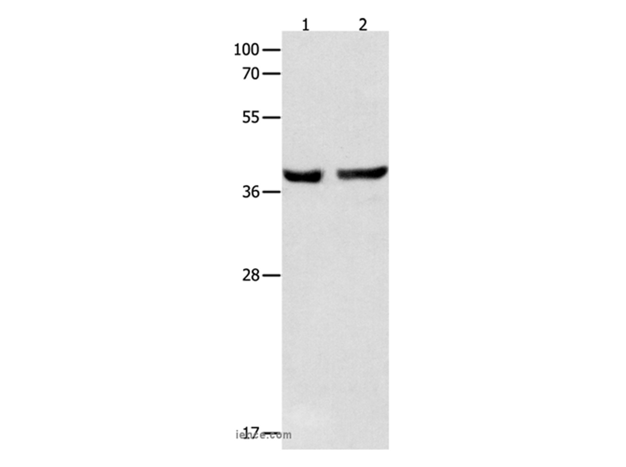 Western Blot analysis of Mouse esophagus and Human cervical cancer tissue  using SERPINB5 Polyclonal Antibody at dilution of 1:1000