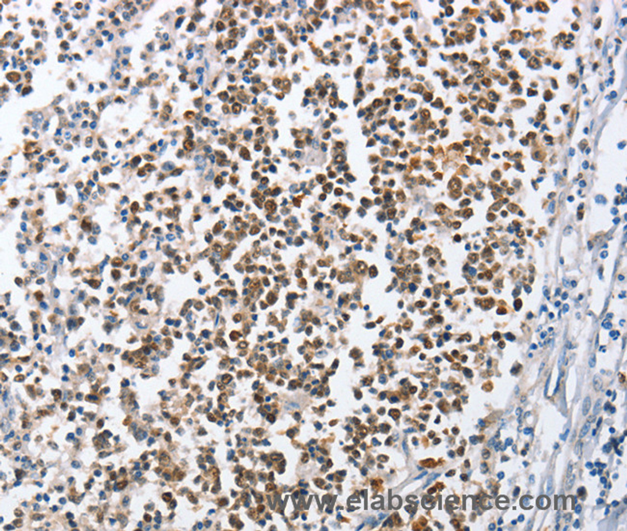 Immunohistochemistry of paraffin-embedded Human tonsil using MCM6 Polyclonal Antibody at dilution of 1:45