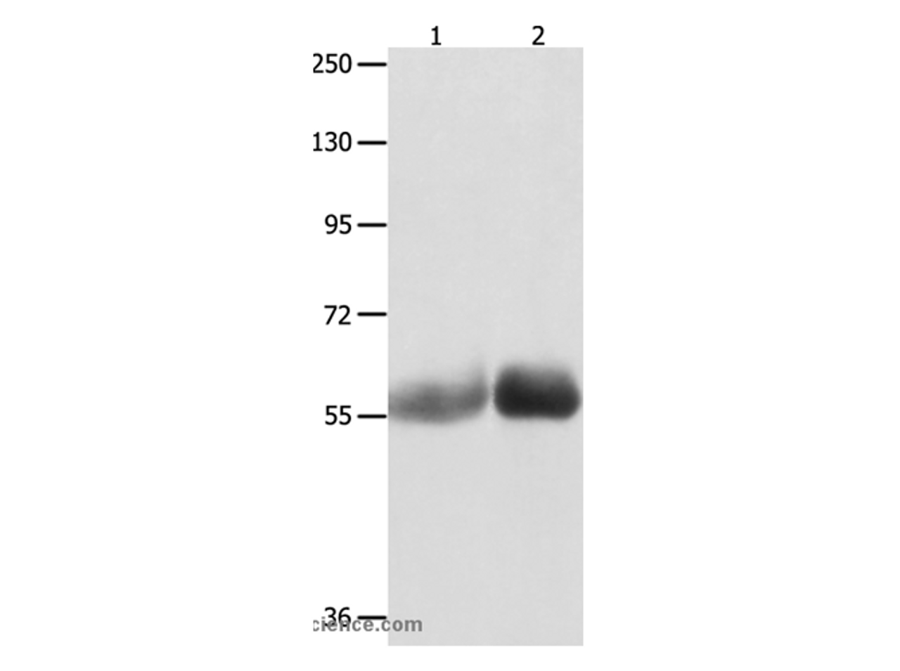 Western Blot analysis of Human liver cancer and stomach cancer tissue  using MUTYH Polyclonal Antibody at dilution of 1:1000