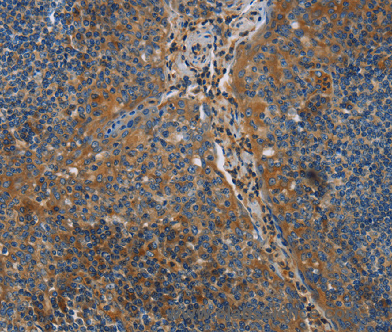 Immunohistochemistry of paraffin-embedded Human tonsil using NRN1 Polyclonal Antibody at dilution of 1:40