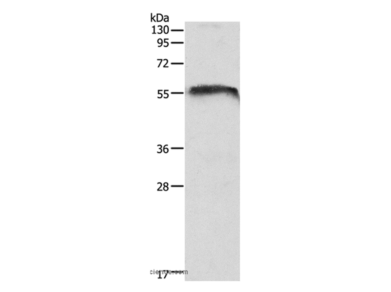Western Blot analysis of Mouse brain tissue using Otocadherin Polyclonal Antibody at dilution of 1:1050