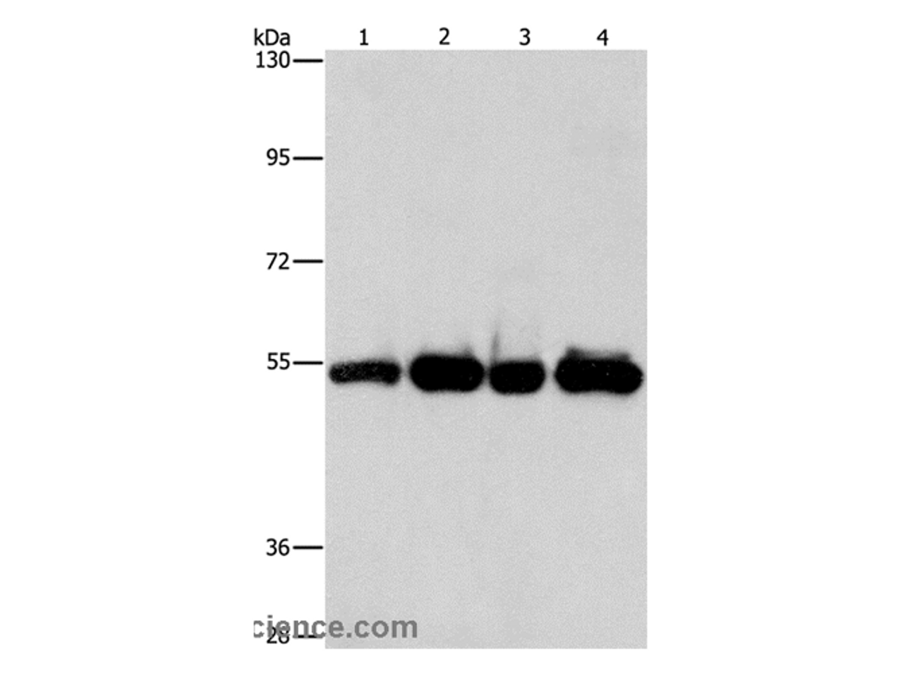 Western Blot analysis of Human bladder carcinoma tissue and A172 cell, Human fetal brain tissue and hela cell using PDE4D Polyclonal Antibody at dilution of 1:500