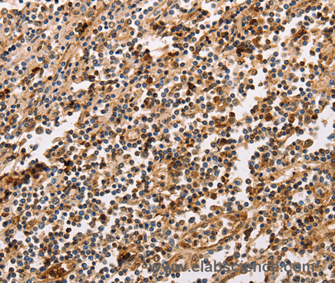 Immunohistochemistry of paraffin-embedded Human tonsil using PPP1CB Polyclonal Antibody at dilution of 1:30