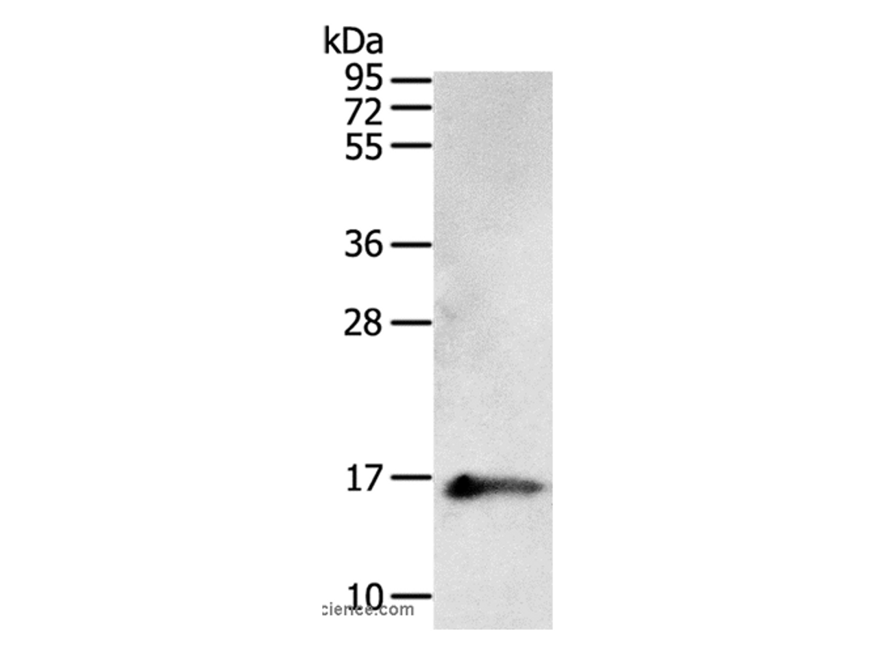 Western Blot analysis of Human fetal brain tissue using PVALB Polyclonal Antibody at dilution of 1:400