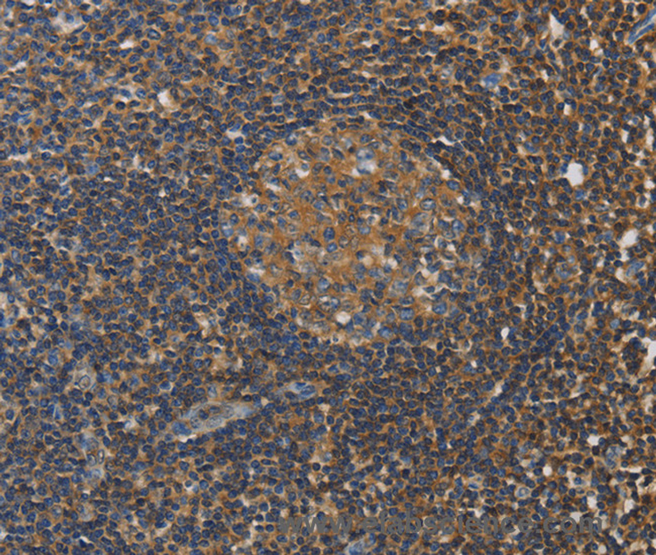 Immunohistochemistry of paraffin-embedded Human tonsil tissue using RAD54L2 Polyclonal Antibody at dilution 1:40
