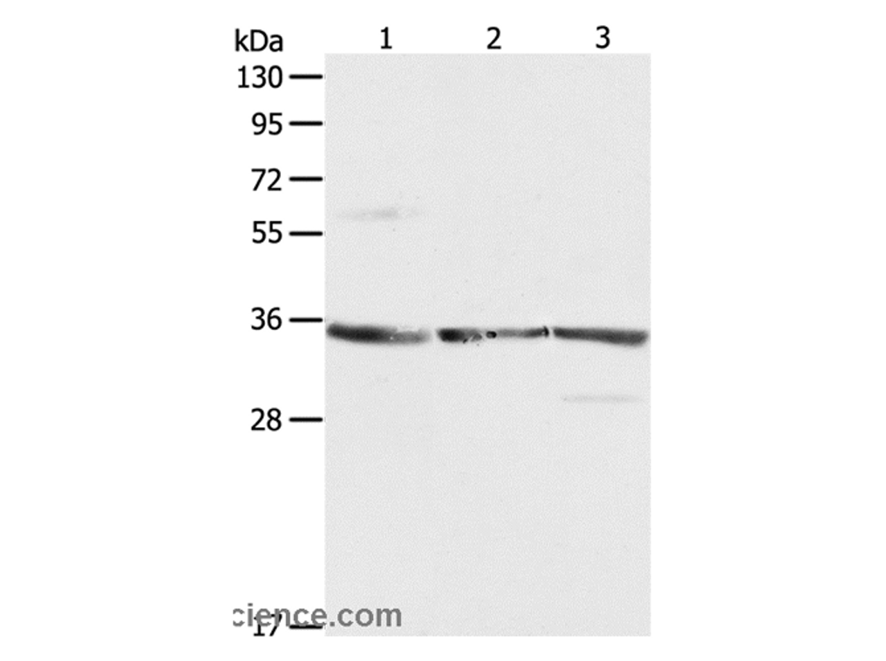 Western Blot analysis of NIH/3T3, A431 and Jurkat cell using RPLP0 Polyclonal Antibody at dilution of 1:750
