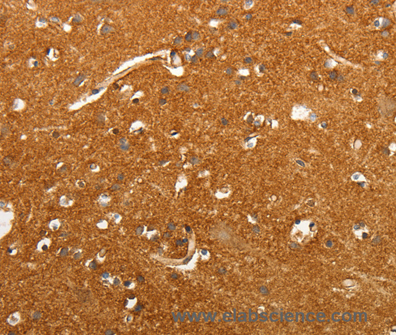 Immunohistochemistry of paraffin-embedded Human brain tissue using SLC4A4 Polyclonal Antibody at dilution 1:50