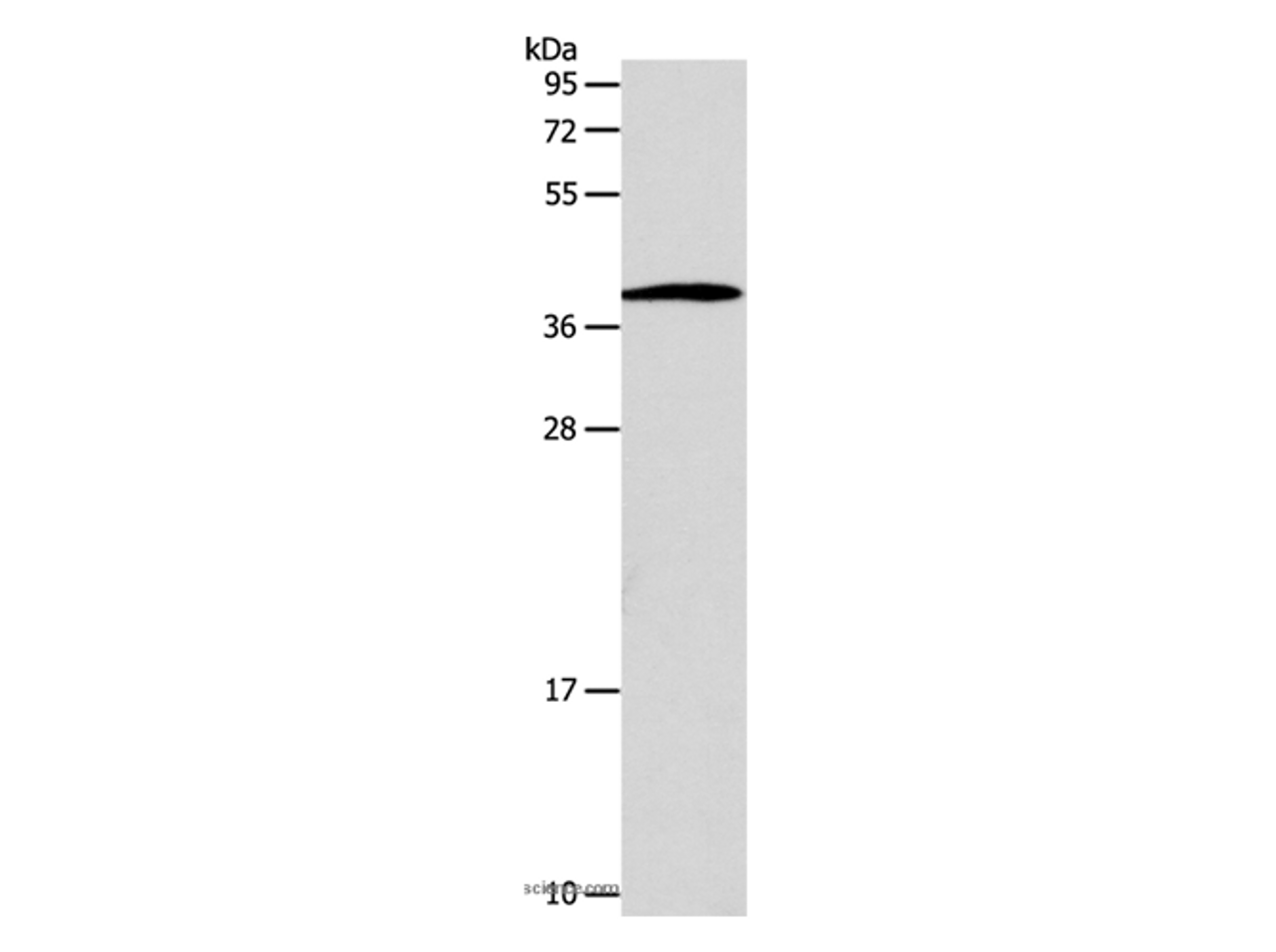 Western Blot analysis of Human lymphoma tissue using SLC25A11 Polyclonal Antibody at dilution of 1:600