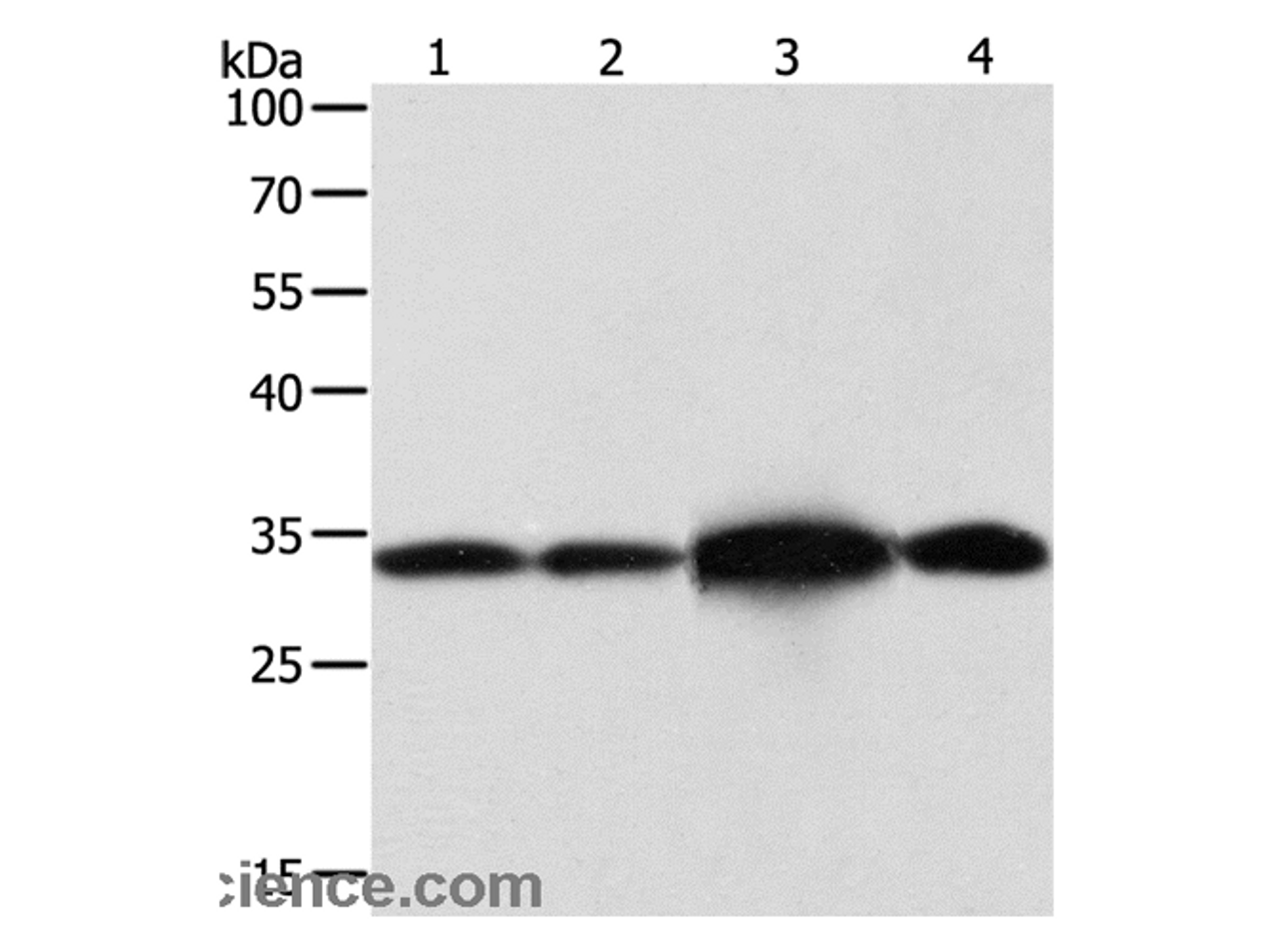 Western Blot analysis of Hela and Jurkat cell, Mouse brain tissue and 293T cell using NAPA Polyclonal Antibody at dilution of 1:500