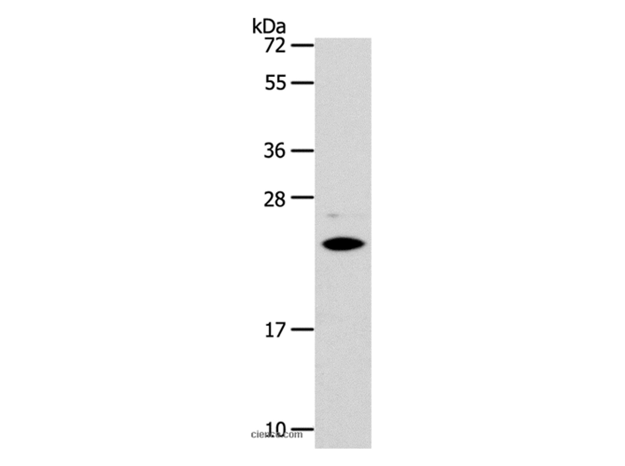Western Blot analysis of Mouse liver tissue using SOD2 Polyclonal Antibody at dilution of 1:950