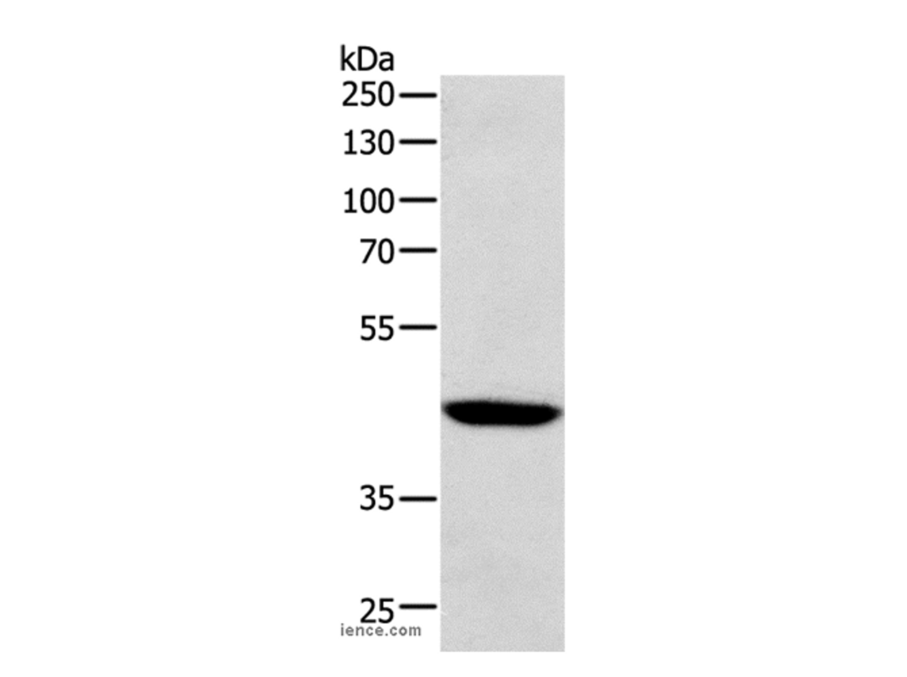 Western Blot analysis of Human lymphoma tissue using SOX-7 Polyclonal Antibody at dilution of 1:1100