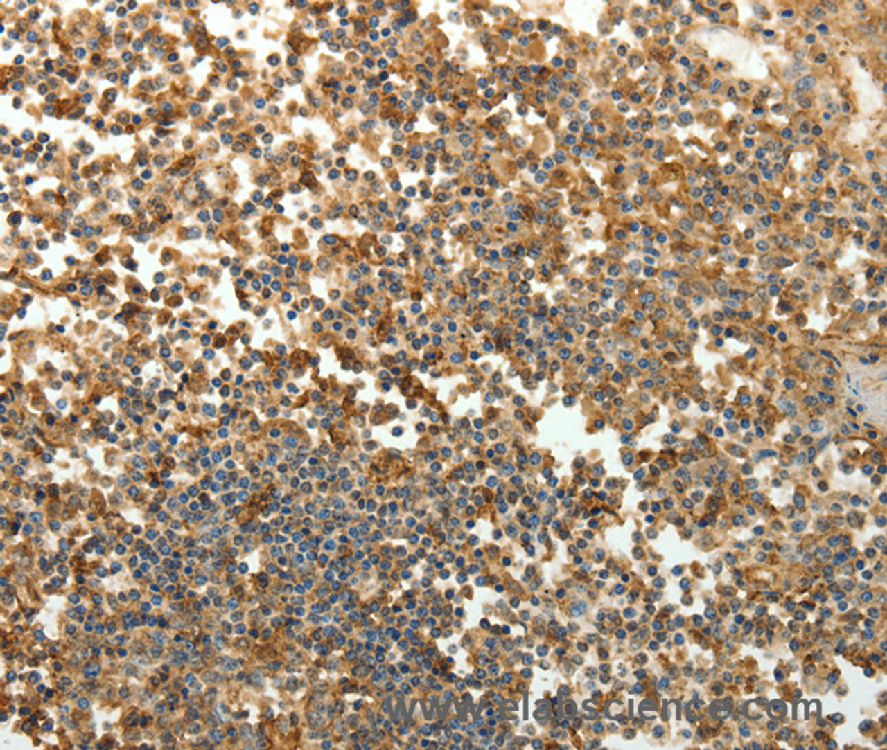 Immunohistochemistry of paraffin-embedded Human tonsil tissue using SFTPD Polyclonal Antibody at dilution 1:30