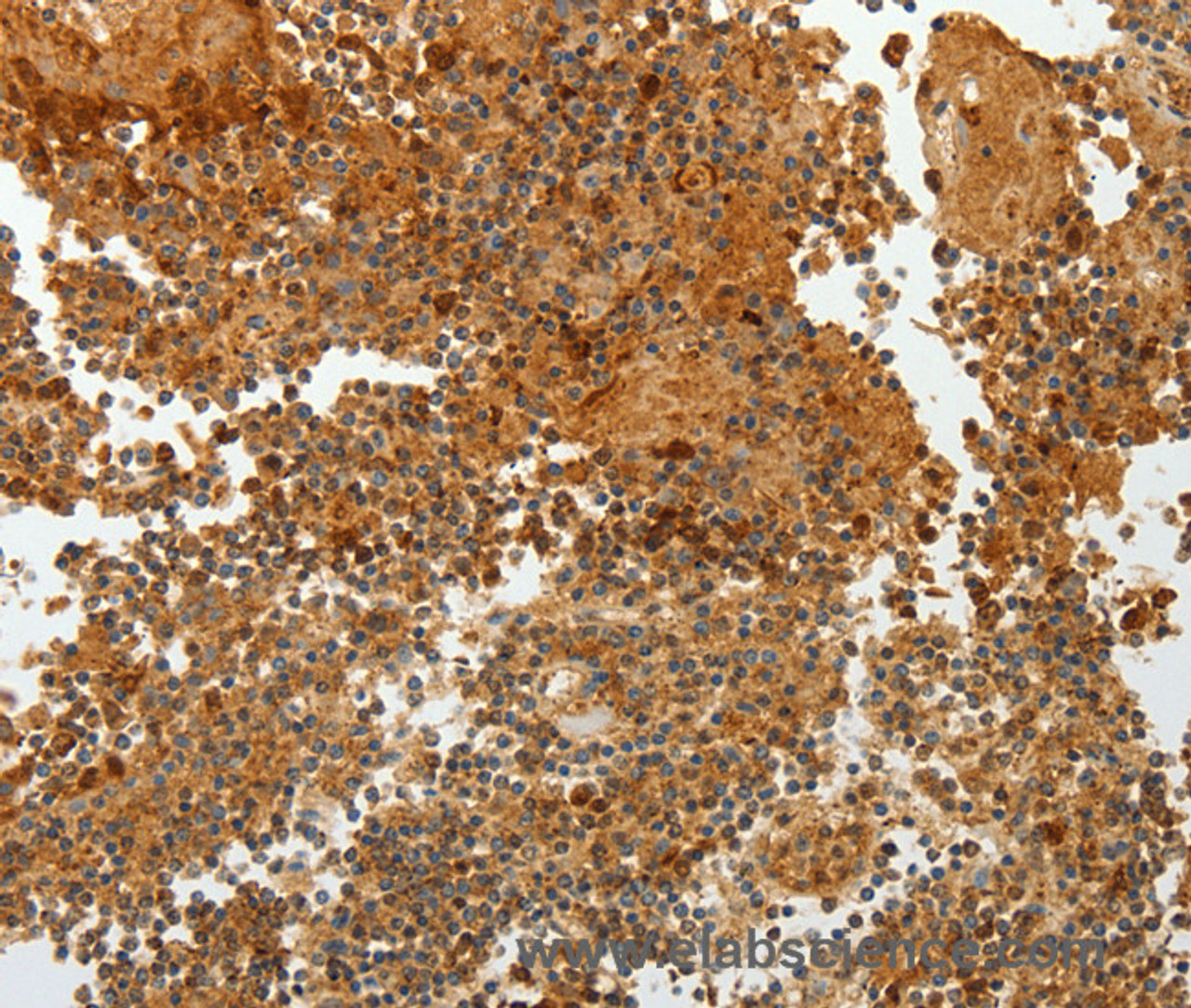 Immunohistochemistry of paraffin-embedded Human tonsil tissue using TFF2 Polyclonal Antibody at dilution 1:40