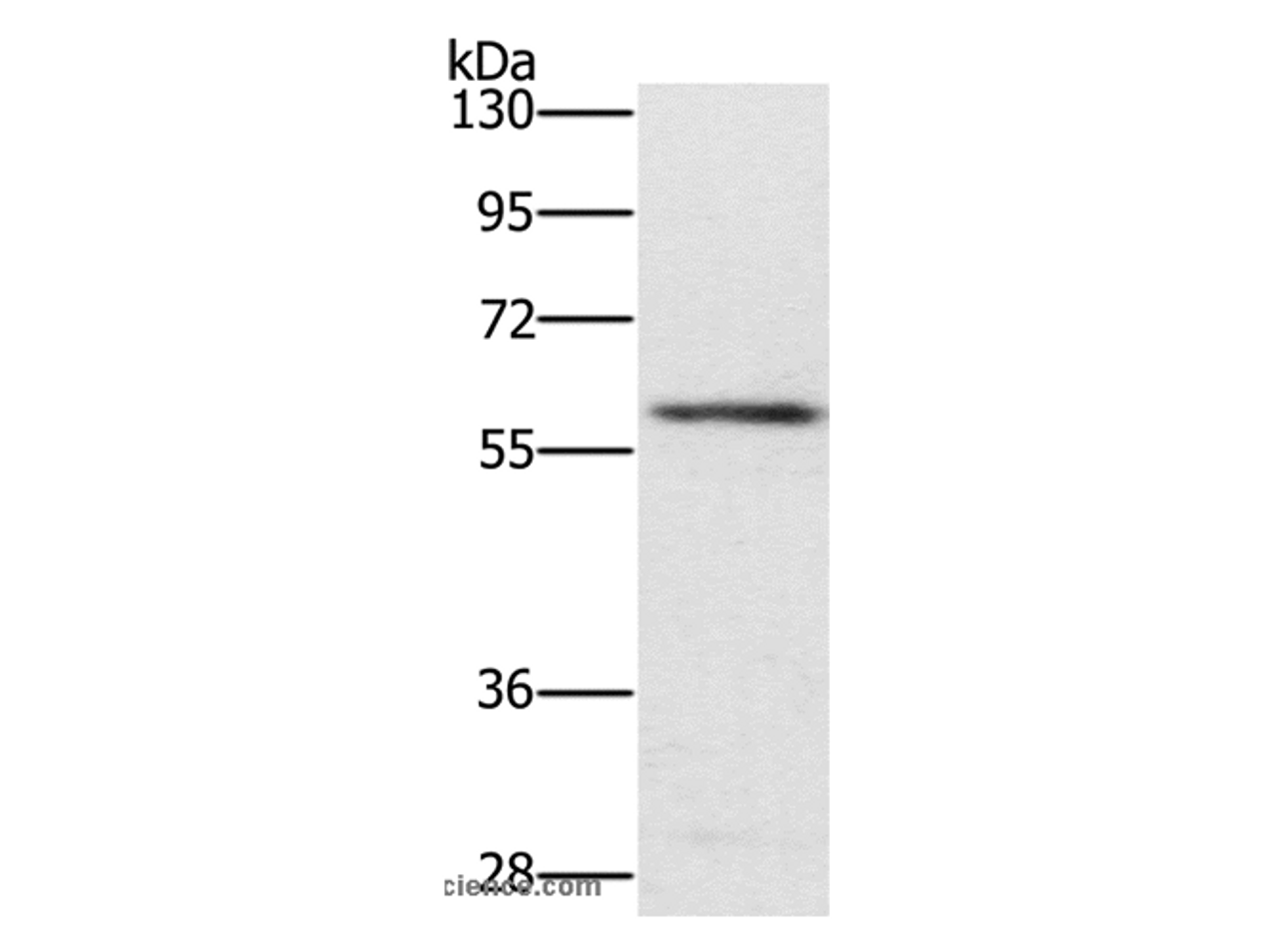 Western Blot analysis of Mouse spleen tissue using TRAFD1 Polyclonal Antibody at dilution of 1:400
