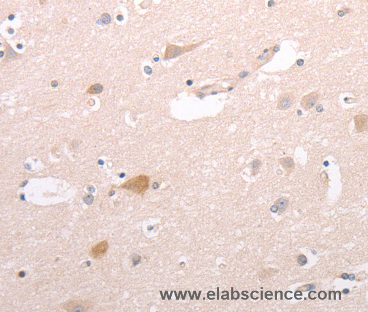 Immunohistochemistry of paraffin-embedded Human brain tissue using CIDEB Polyclonal Antibody at dilution 1:50