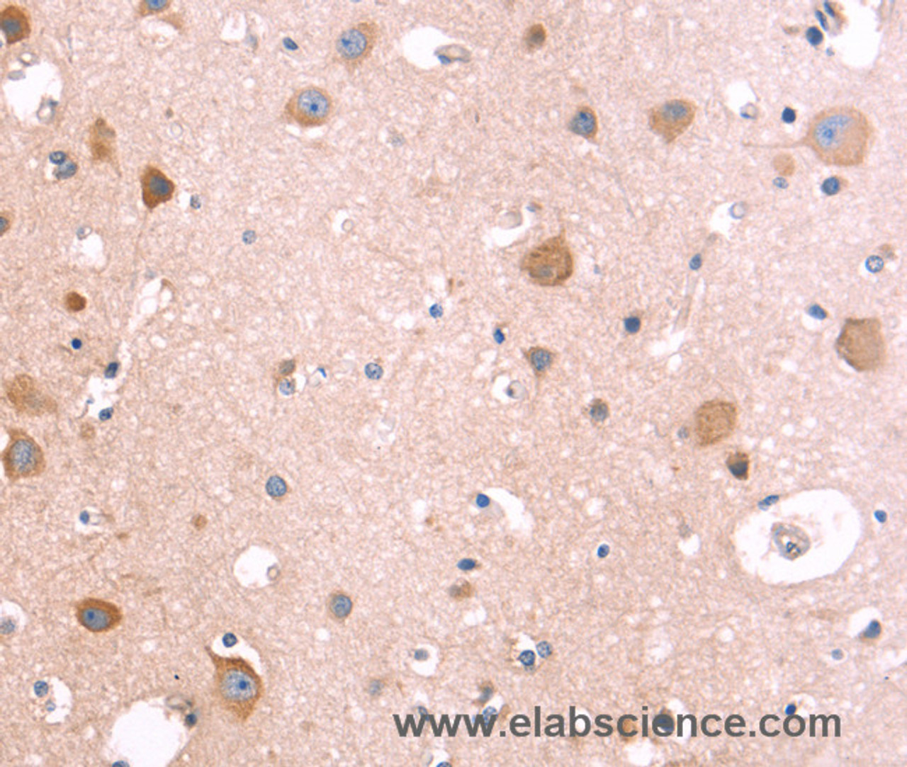 Immunohistochemistry of paraffin-embedded Human brain using ST2 Polyclonal Antibody at dilution of 1:40