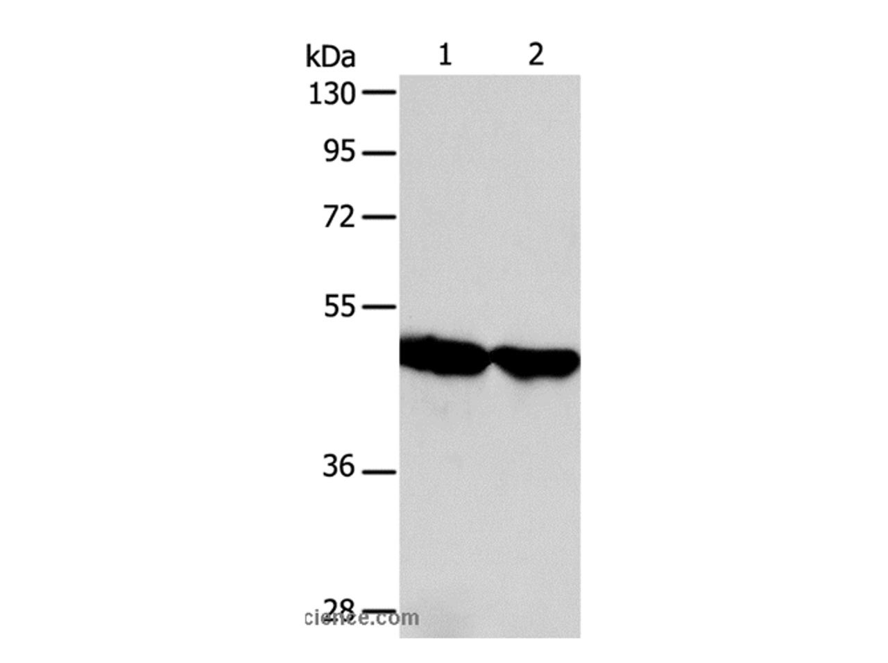 Western Blot analysis of Human fetal liver and liver cancer tissue using AADAC Polyclonal Antibody at dilution of 1:600