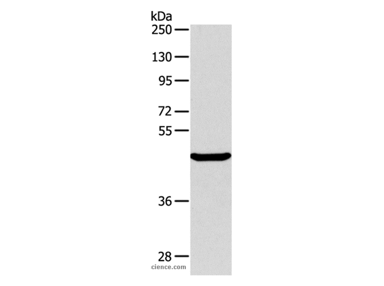Western Blot analysis of Mouse pancreas tissue using ALKBH1 Polyclonal Antibody at dilution of 1:400