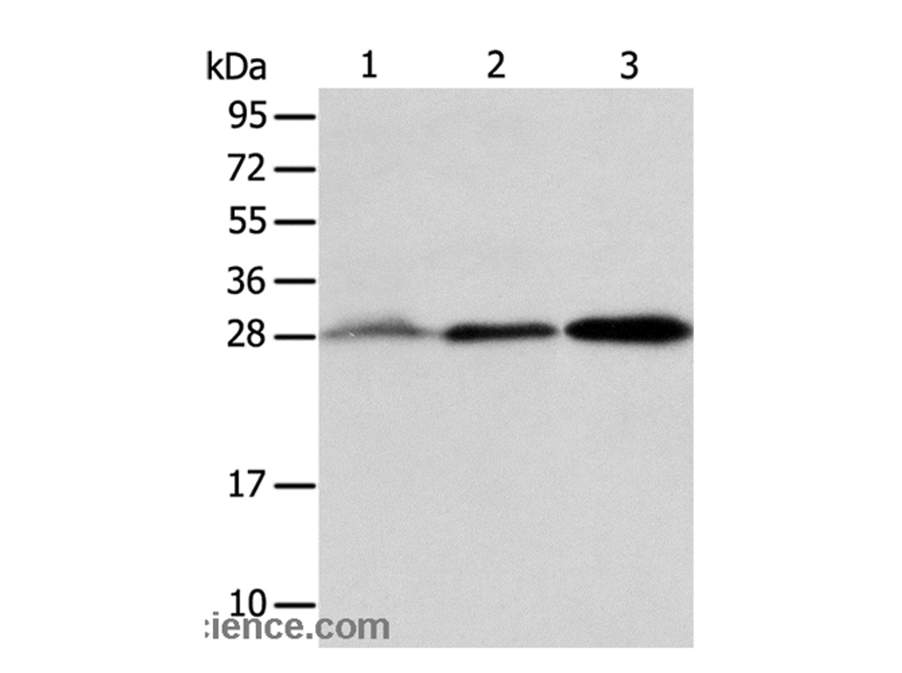 Western Blot analysis of Human fetal liver and seminoma tissue, RAW264.7 cell using ALKBH2 Polyclonal Antibody at dilution of 1:800