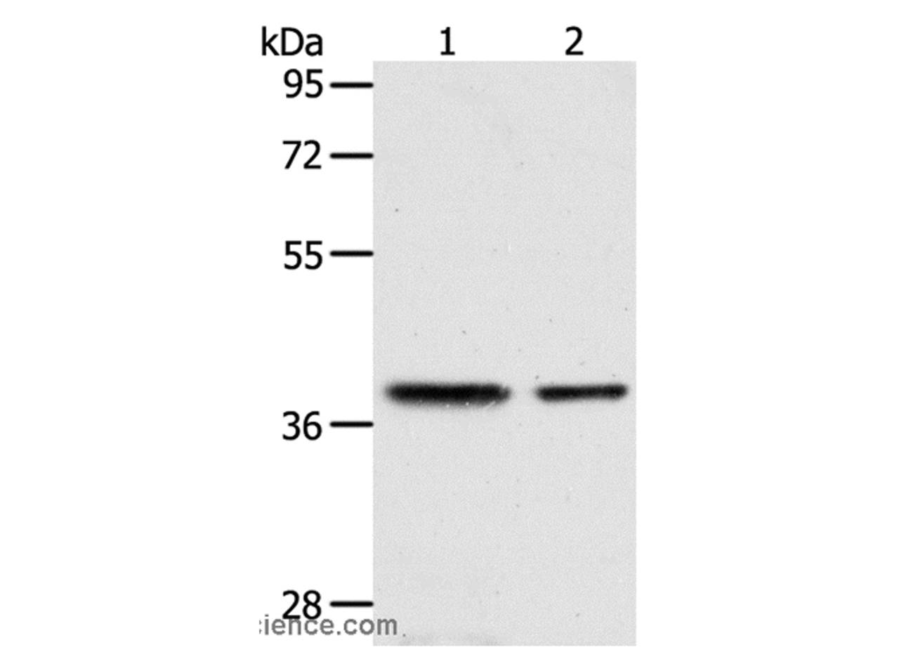 Western Blot analysis of Human fetal kidney and fetal muscle tissue using CNN3 Polyclonal Antibody at dilution of 1:400