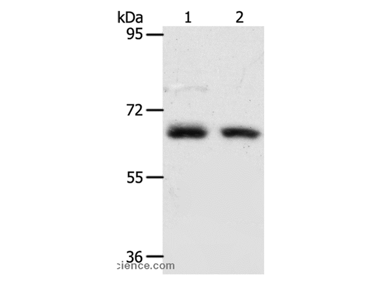 Western Blot analysis of Human fetal kidney and fetal lung tissue using ACOT11 Polyclonal Antibody at dilution of 1:450