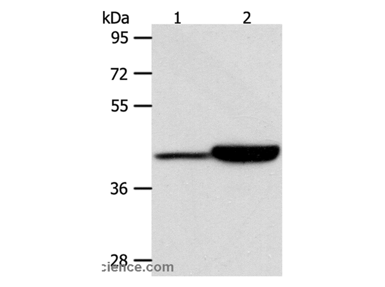 Western Blot analysis of Jurkat and RAW264.7 cell using CAPG Polyclonal Antibody at dilution of 1:950