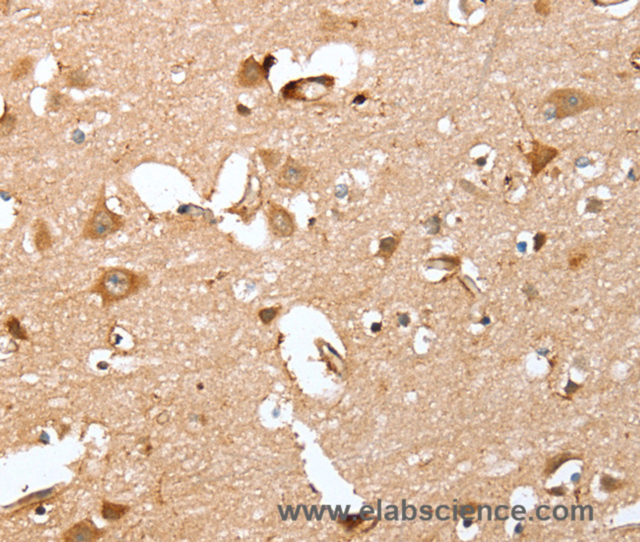Immunohistochemistry of paraffin-embedded Human brain using CAPG Polyclonal Antibody at dilution of 1:40