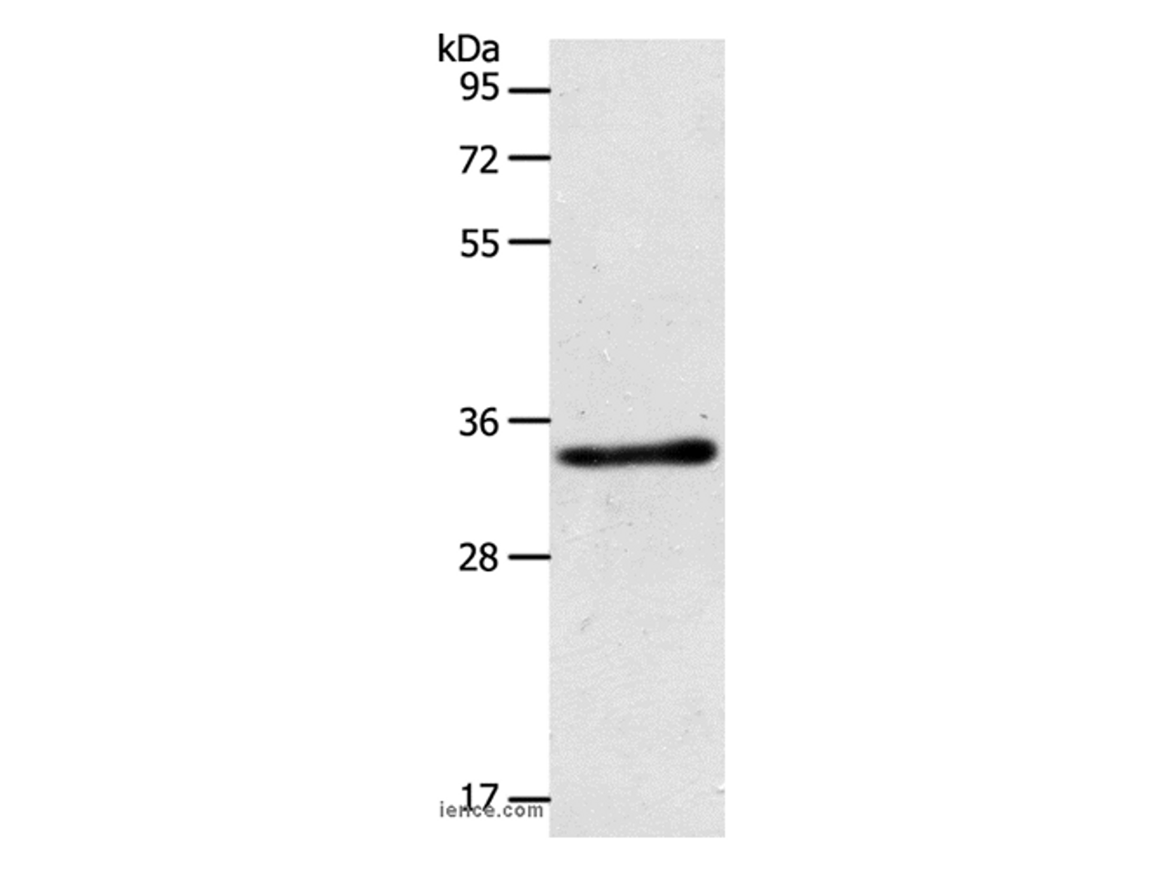 Western Blot analysis of Mouse kidney tissue using ACY3 Polyclonal Antibody at dilution of 1:500