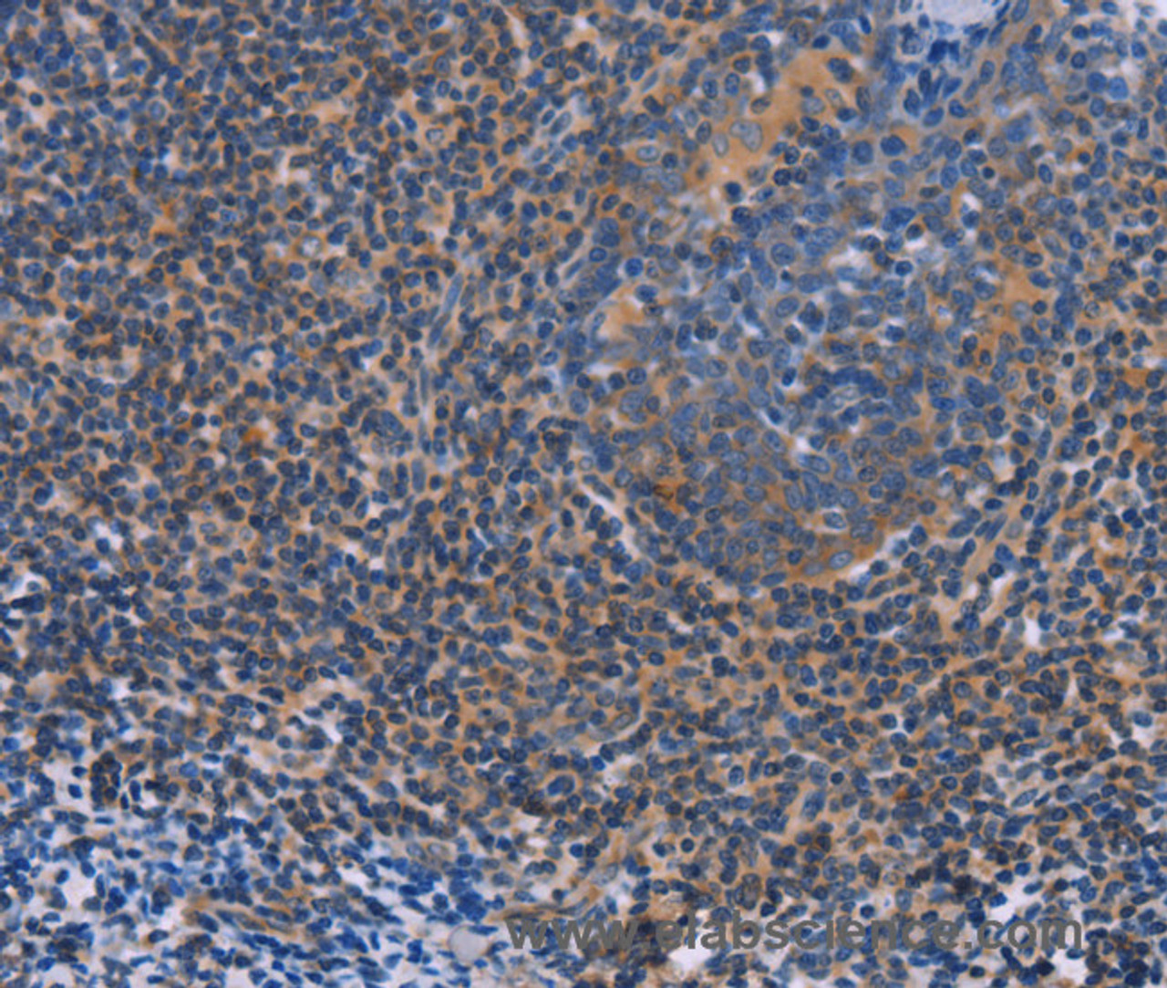 Immunohistochemistry of paraffin-embedded Human tonsil using AGFG1 Polyclonal Antibody at dilution of 1:60