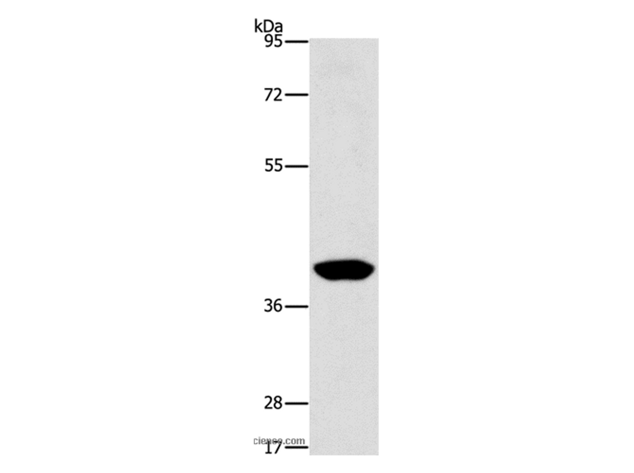Western Blot analysis of Human lymphoma tissue using PHYKPL Polyclonal Antibody at dilution of 1:500